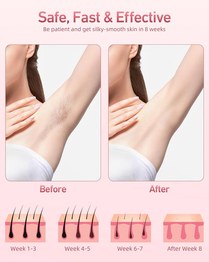 TSUYAGLA Laser Hair Removal For Women